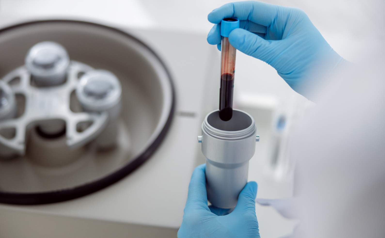 Innovative ED TreatmentSexual Regenerative Cell Therapy For ED